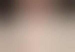 tepel36